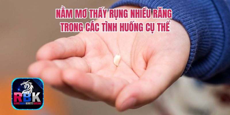 Nằm Mơ Thấy Rụng Nhiều Răng Có Điềm Gì? Tốt Hay Xấu? 